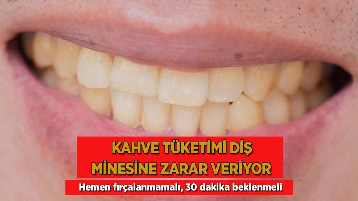 Kahve diş minesini mahvediyor! Hemen fırçalamak yanlış, 30 dakika bekleyin