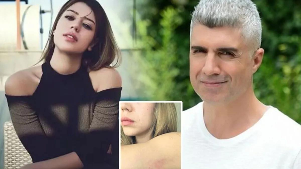 Özcan Deniz’in eski eşi Feyza Aktan şiddet gördüğü iddiaları hakkında ilk kez konuştu: Darp izleri…